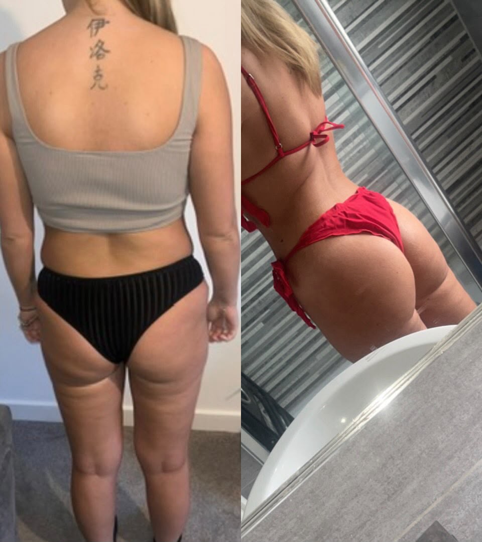 Client transformation before and after collage