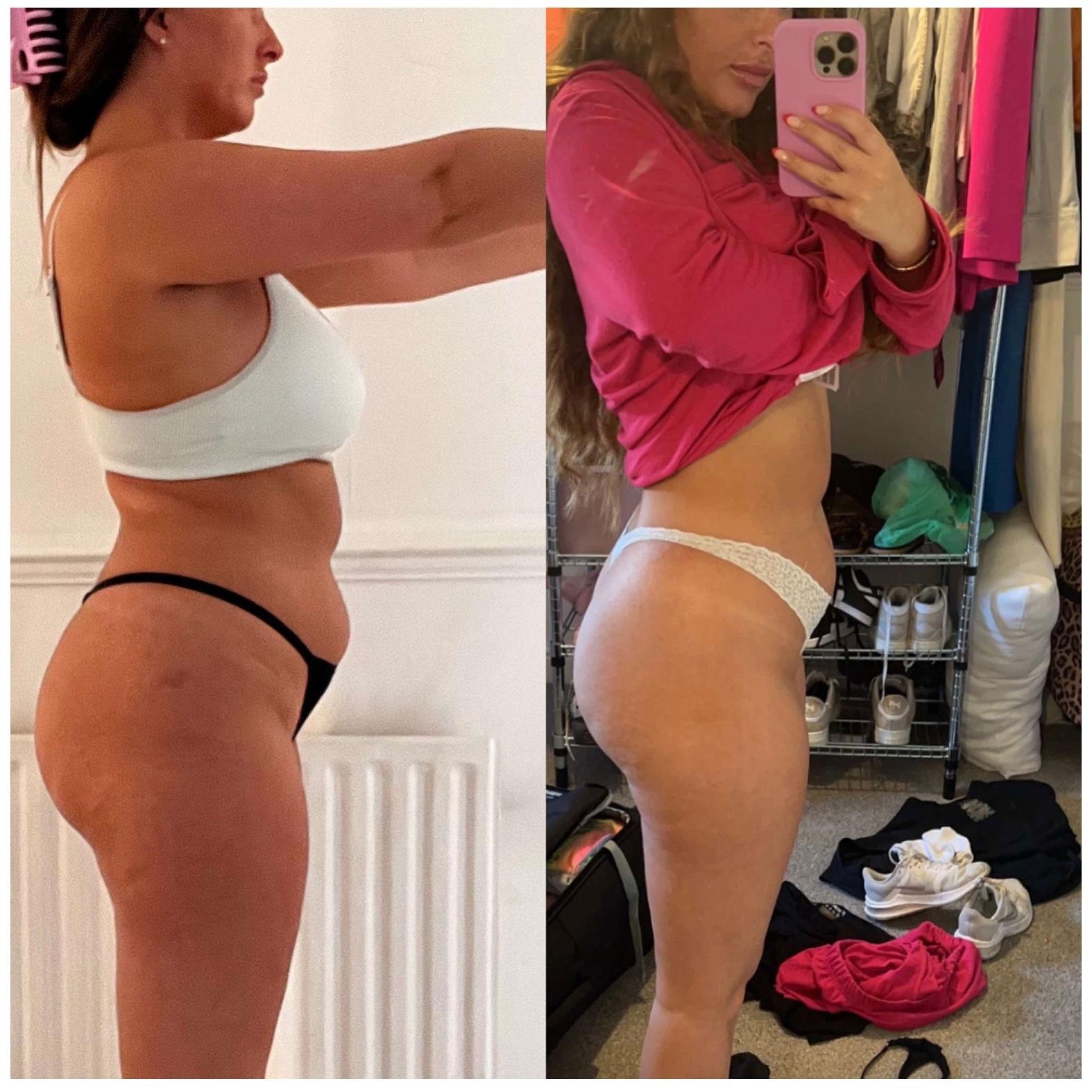Client transformation before and after collage
